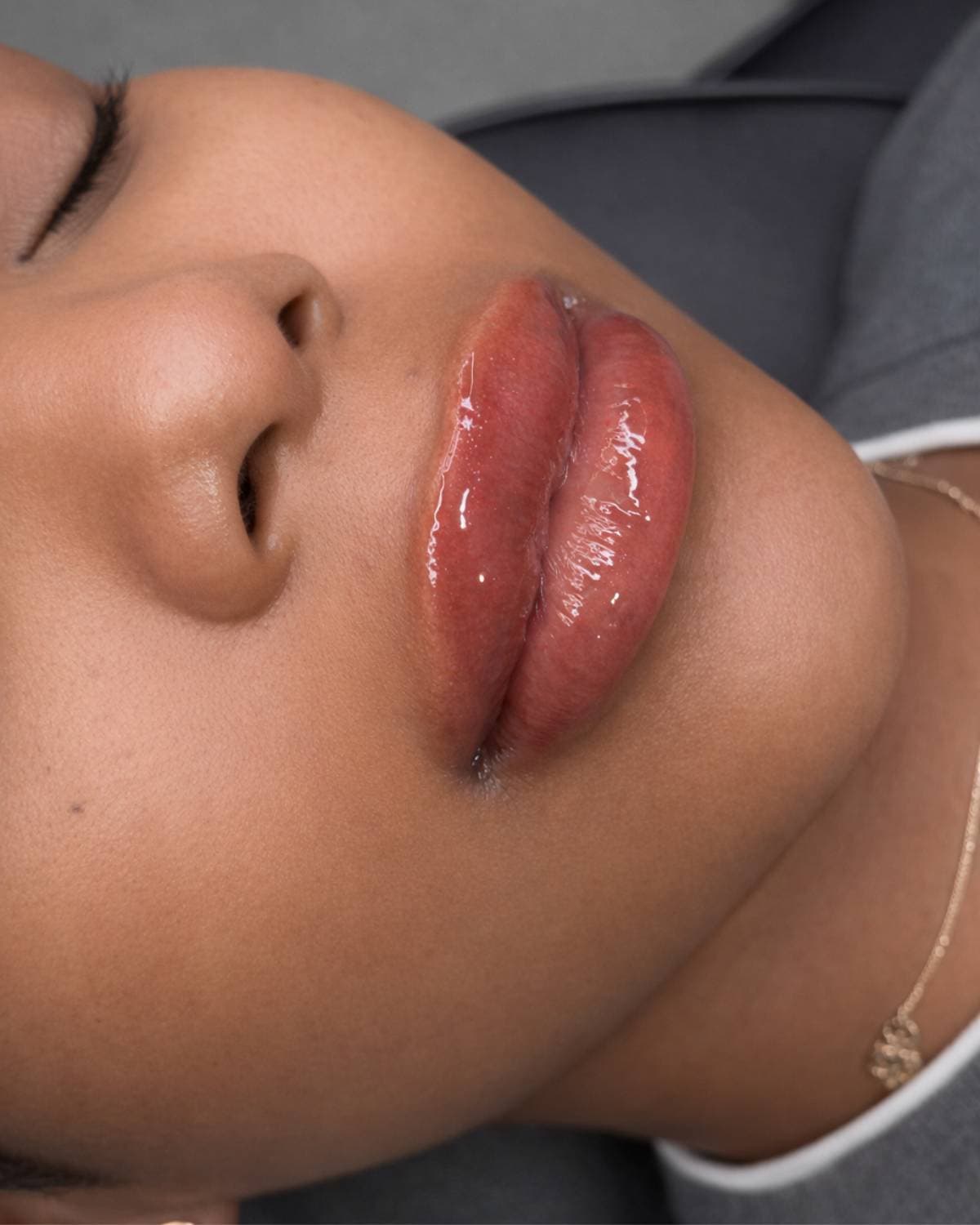The same client's lips immediately after neutralisation — a warmer, more even tone