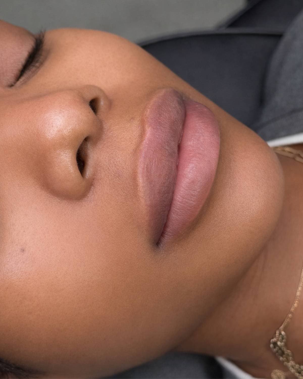 A client's lips before neutralisation — a cool, uneven undertone